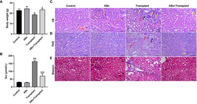 Antibiotic ampicillin induces immune tolerance in renal transplantation by regulating the proportion of intestinal flora in mice